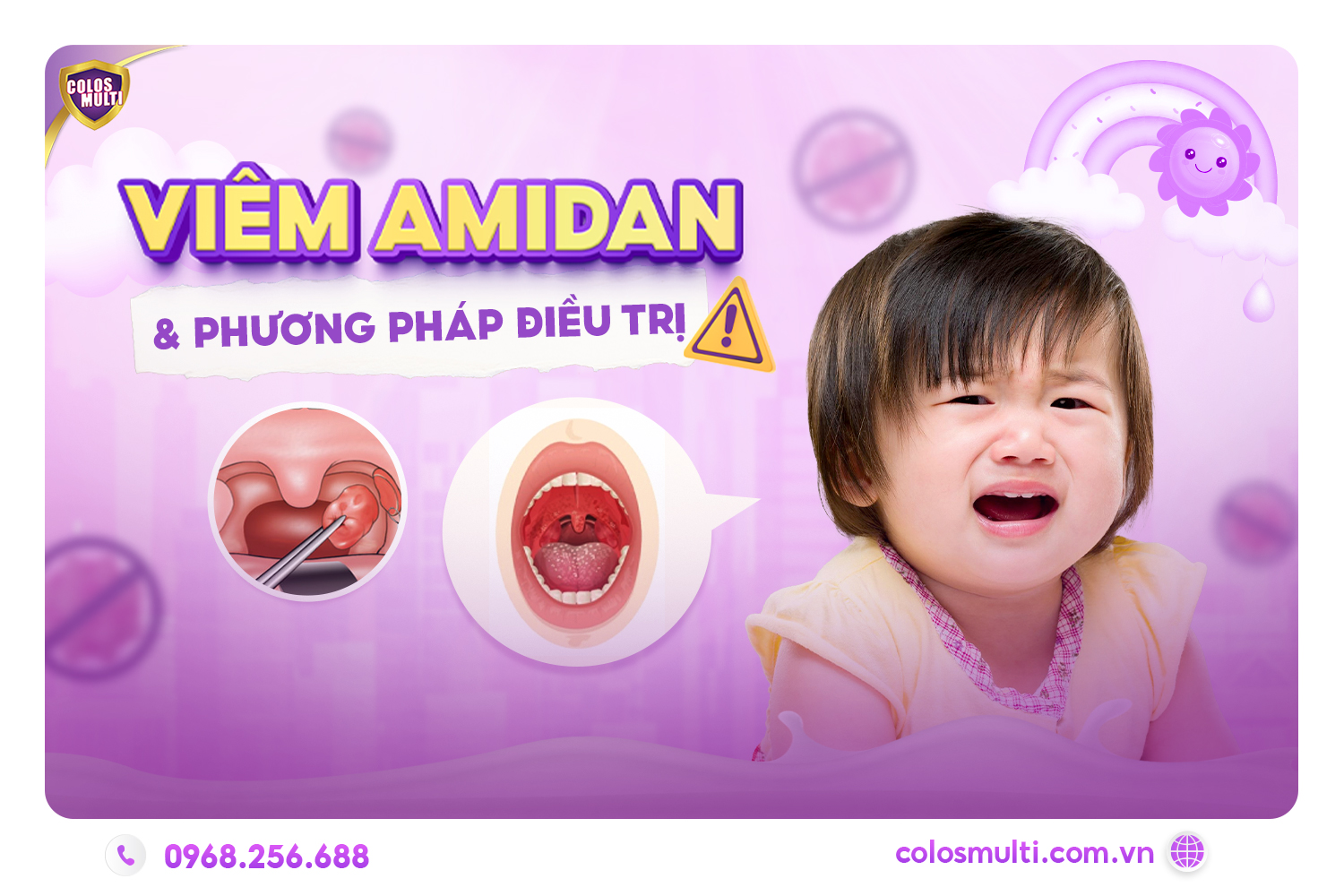 Viêm amidan và phương pháp điều trị