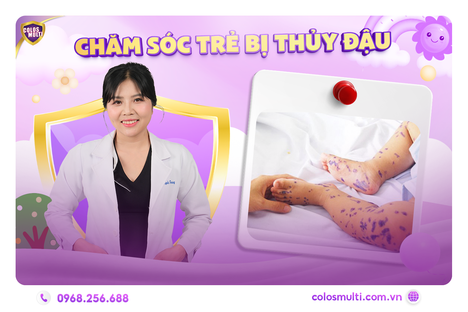Chăm sóc trẻ bị thủy đậu tại nhà